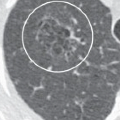 Internal Opacities